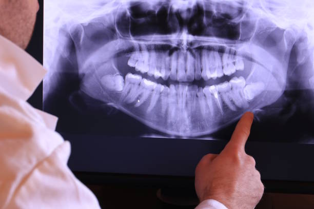 Best Emergency Dental Services for Seniors in Monfort Heights, OH